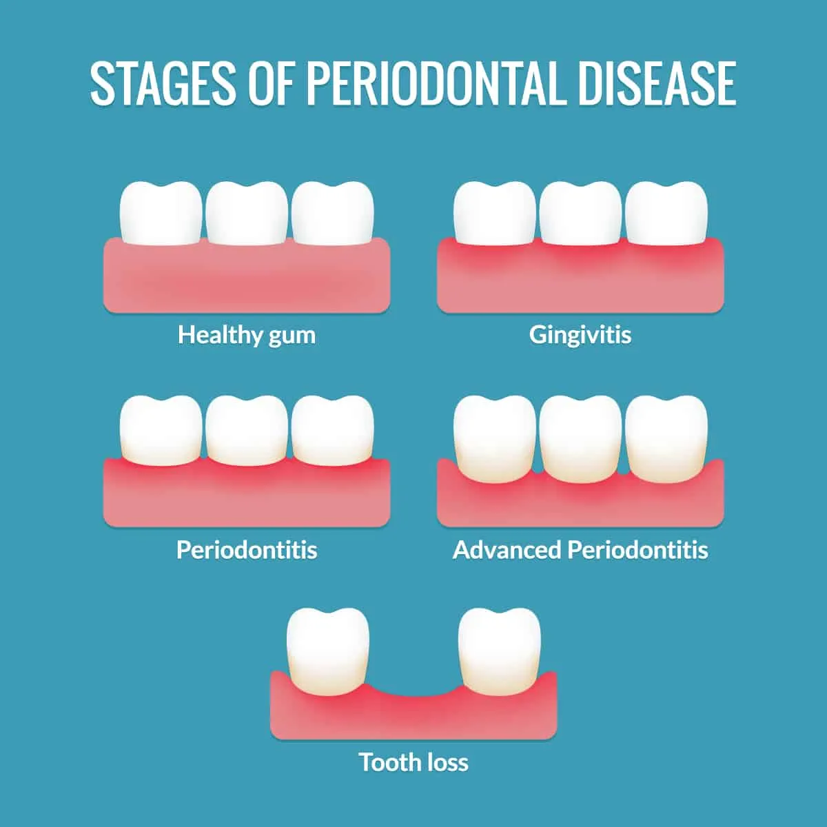 Periodontics