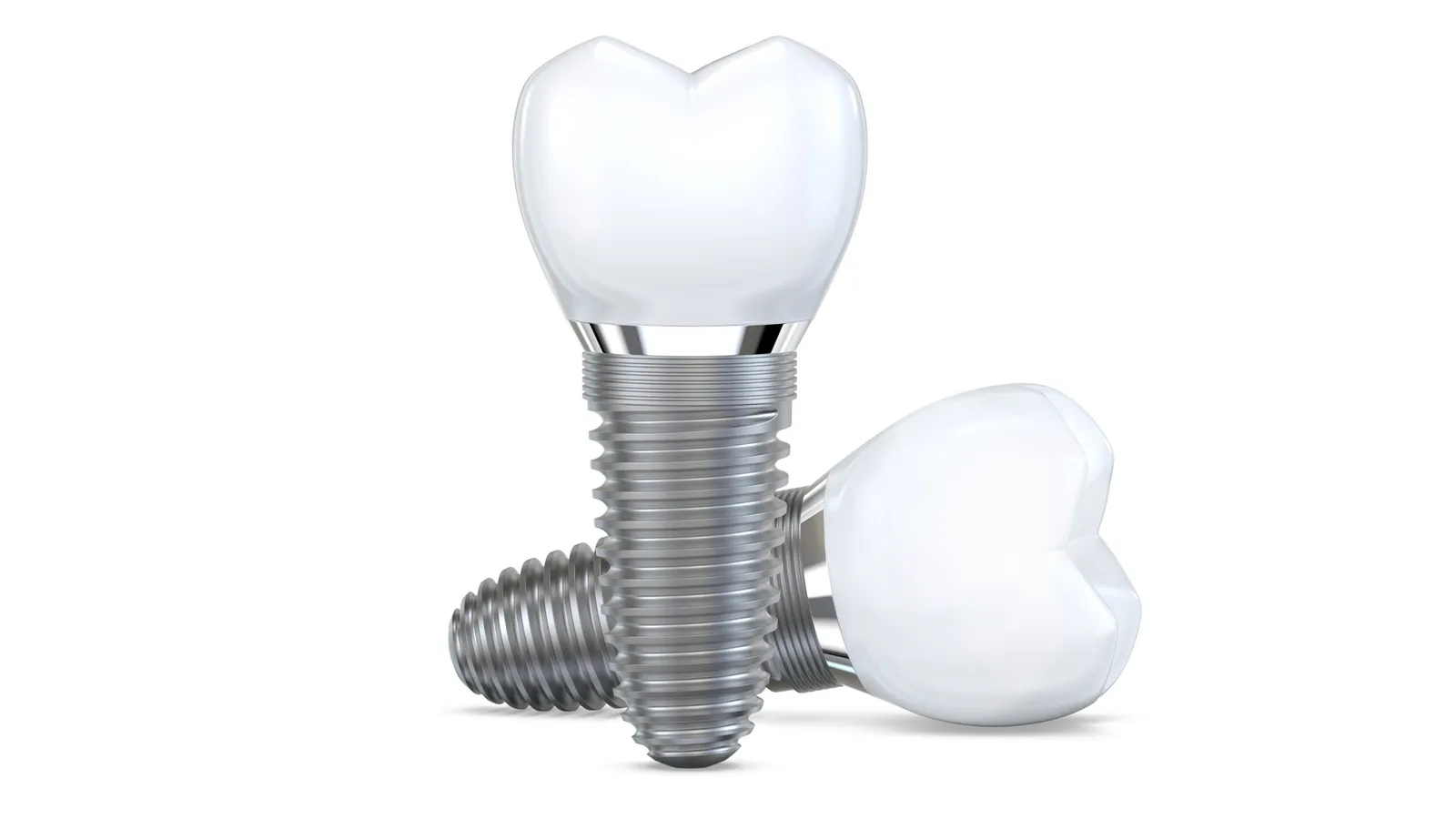 Does Insurance Cover Crowns? (Delta Dental, Anthem, PPO, HMO — Downey Guide)