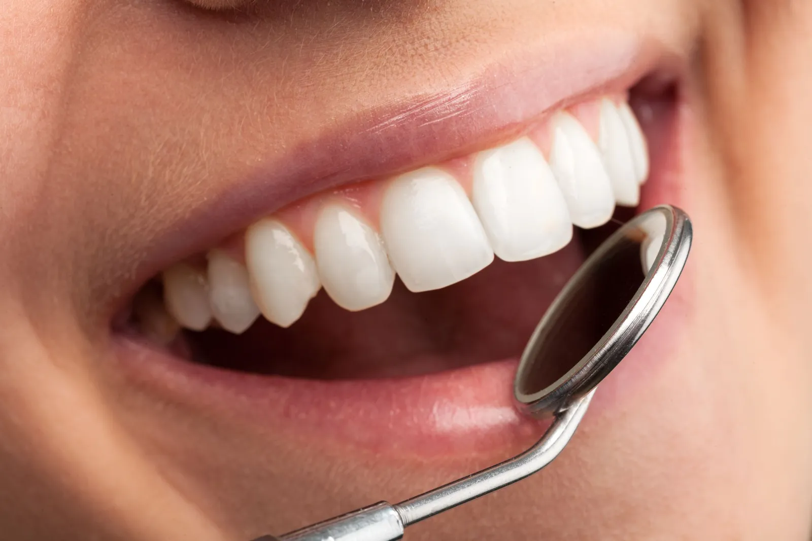 Why Dental Problems Are More Common in Downey &amp; Pico Rivera (Local Water, Diet &amp; Stress Data)